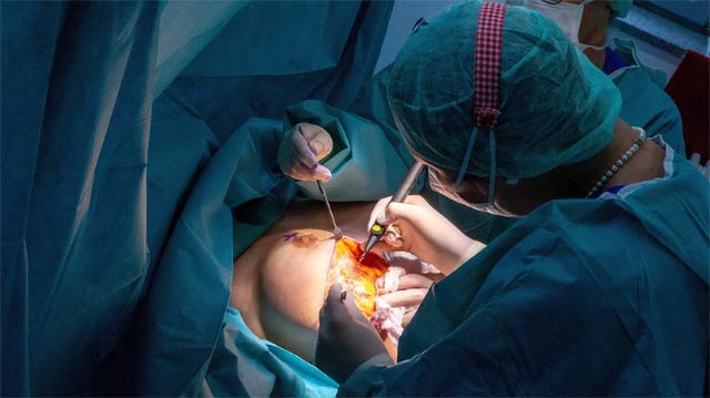 Caty Lugener wird von der Plastischen Chirurgin in München, Dr. Med. Christina Günter an der Brust operiert